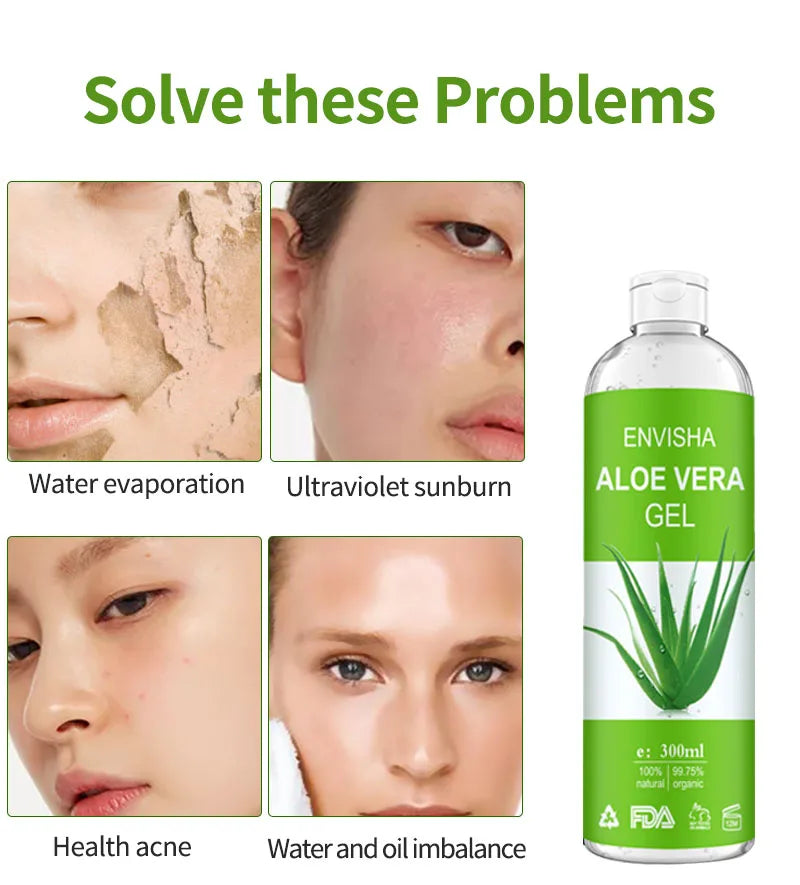 ENVISHA Aloe Vera Gel! 🧴🌵🌞